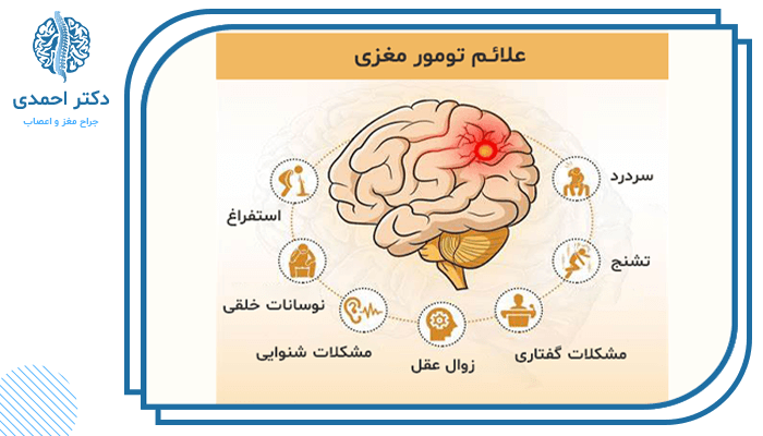 علائم عمومی تومور مغزی