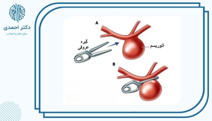 علائم هشداردهنده پس از جراحی