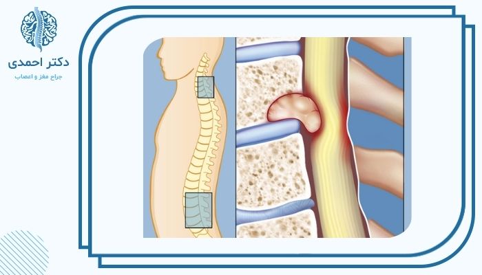 مقایسه تومورهای اولیه و متاستاتیک مقایسه تومورهای اولیه و متاستاتیک