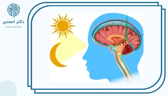 اختلالات خواب چه تاثیری بر عملکرد مغز دارند؟ اختلالات خواب چه تاثیری بر عملکرد مغز دارند؟
