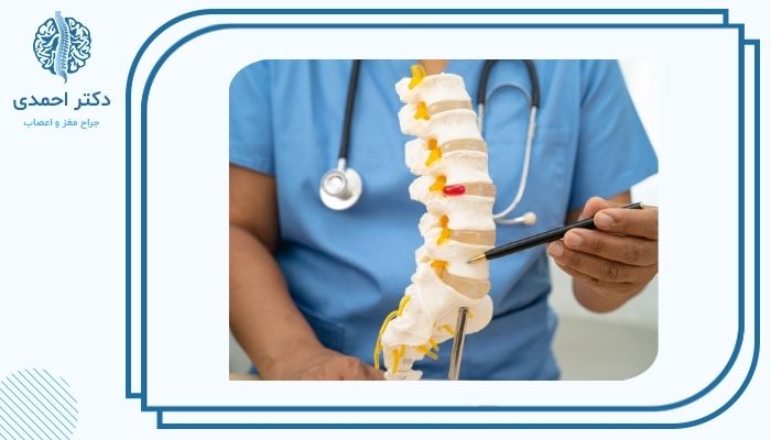 پیشگیری از عود دیسک پس از عمل