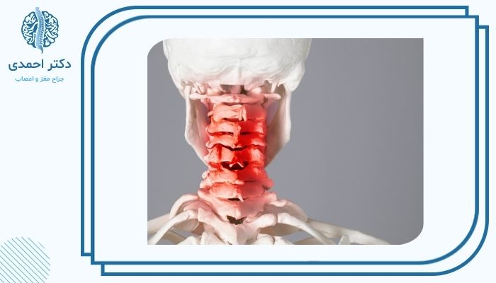 فرق دیسک گردن با آرتروز گردن چیست؟ فرق دیسک گردن با آرتروز گردن چیست؟