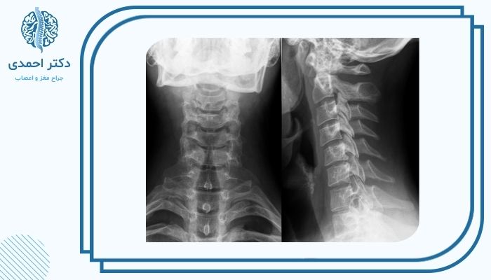 تفاوت در نحوه تشخیص