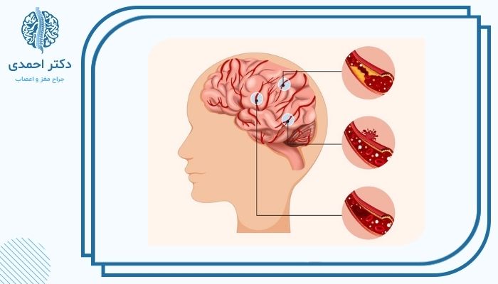 چه عواملی خطر مرگ را افزایش میدهند؟ چه عواملی خطر مرگ را افزایش میدهند؟
