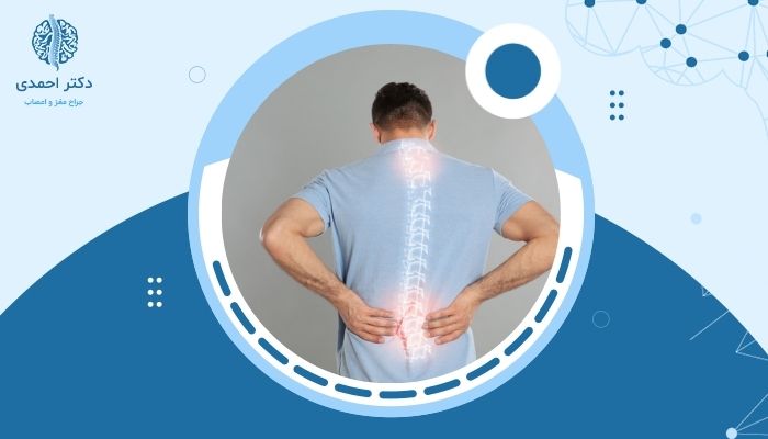 آیا بیرون زدگی دیسک کمر می‌تواند باعث فلج شود؟