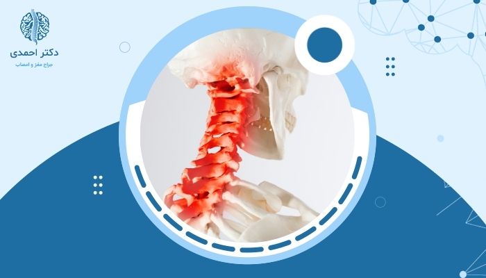 آیا دیسک گردن می‌تواند باعث درد در شانه‌ها و دست‌ها شود؟