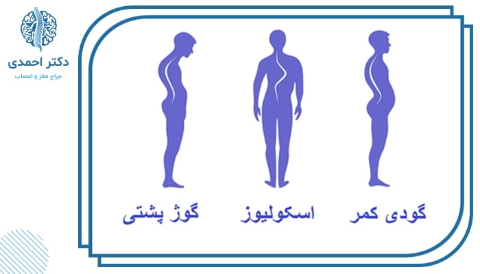 انحرافات ستون فقرات و گوژ پشتی