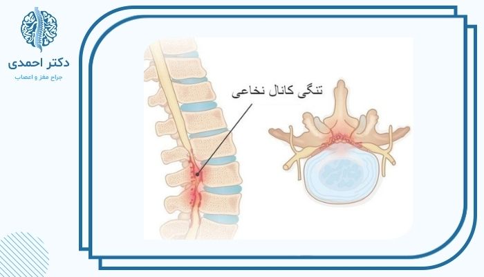 کدام روش جراحی بهتر است؟