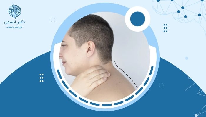 چرا گردنم به جلو خم شده؟ علت و روش درمان قوز گردن چرا گردنم به جلو خم شده؟ علت و روش درمان قوز گردن