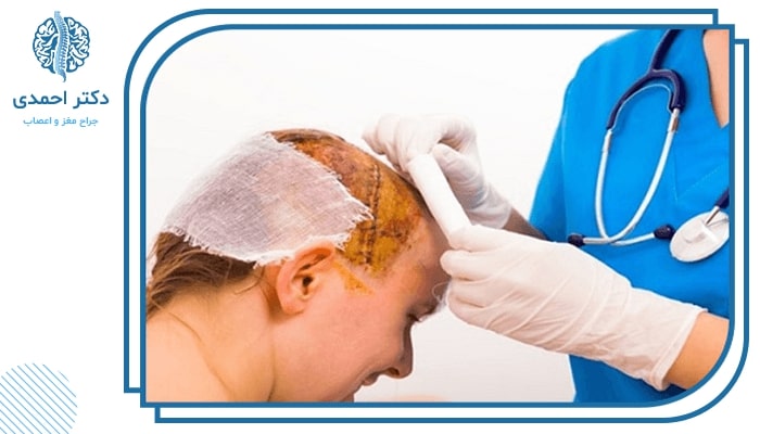 چه زمانی نیاز به جراحی تومور است؟ چه زمانی نیاز به جراحی تومور است؟